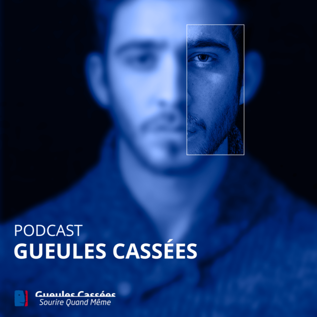 Gueules Cassées